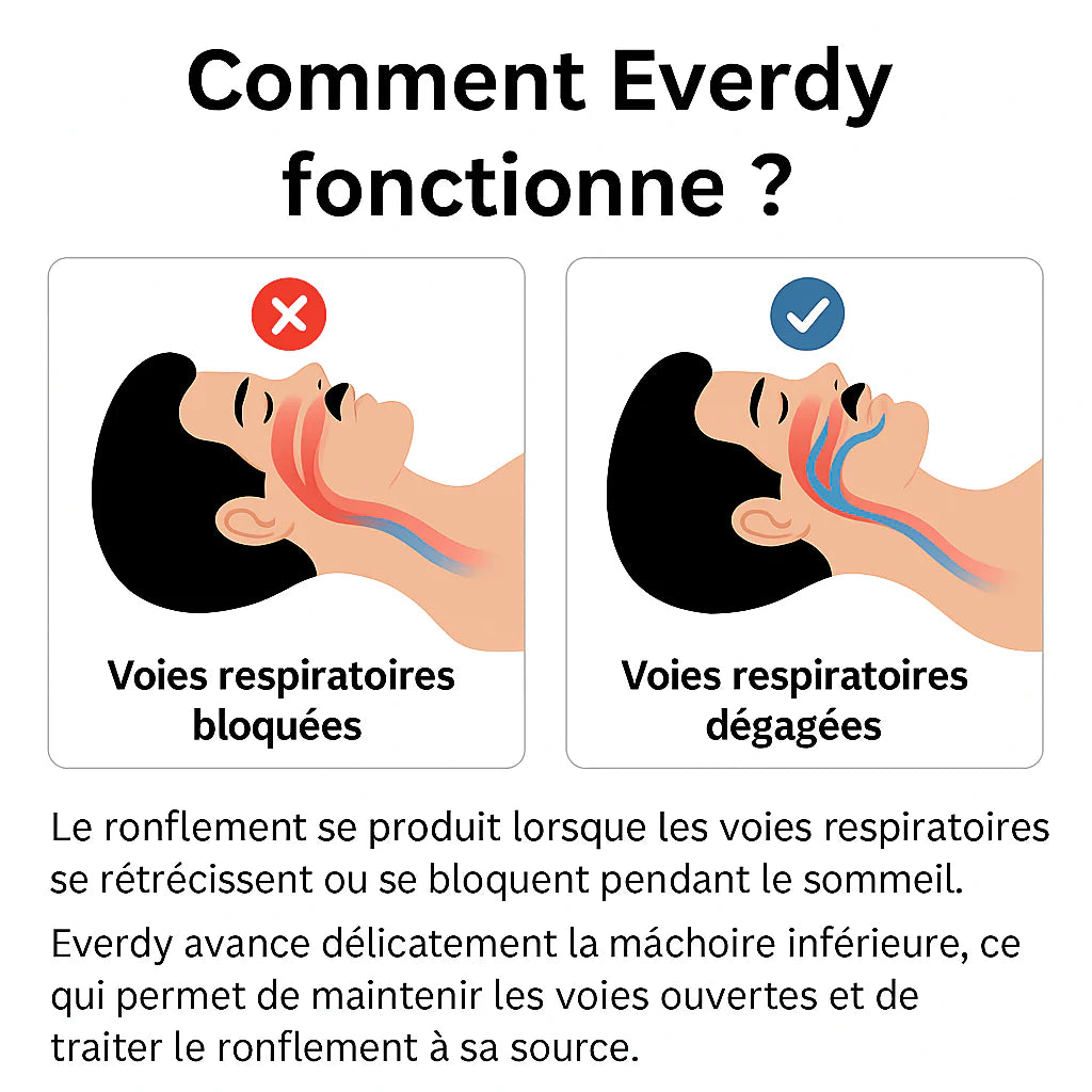 Solution Anti-Ronflement Efficace Dès la Première Nuit